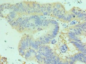 Cadherin-17 antibody