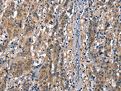 CDH5 Antibody