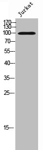 Cadherin-17 antibody