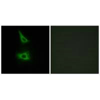 CDH17 Antibody