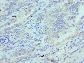 CADM1 antibody