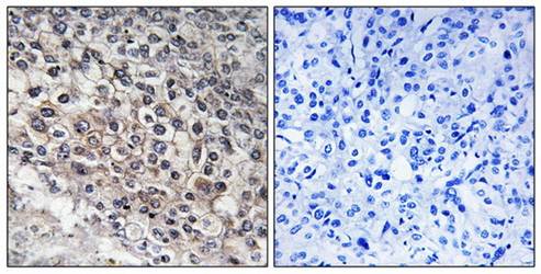 Cytochrome P450 2W1 Antibody