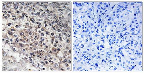 CADM2 antibody