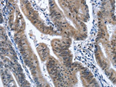 CADM3 Antibody