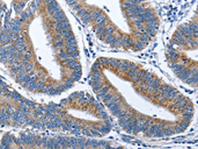 CADM3 Antibody