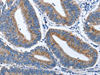 CADM3 antibody