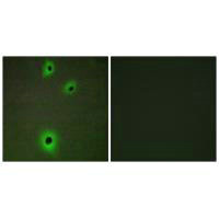 CADM4 Antibody