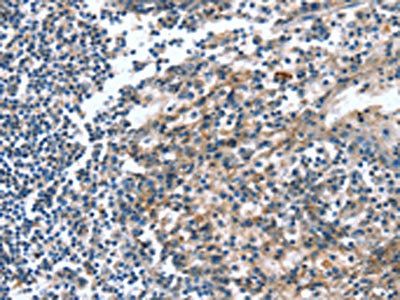 CAGE1 Antibody