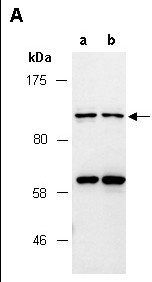 CAGE1 (N) Antibody, Rabbit Polyclonal