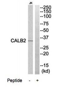 CALB2 Antibody