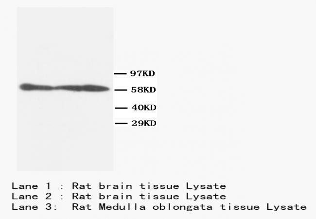 Calcineurin Alpha Ppp3r1 Antibody (Monoclonal, CN-A1)