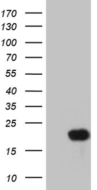 Calcium binding protein P22 (CHP1) antibody