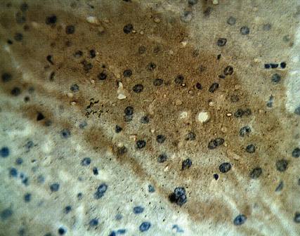 Rabbit anti Human Calcium Homeostasis Modulator Protein 1