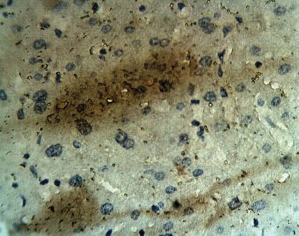 Rabbit anti Human Calcium Homeostasis Modulator Protein 1