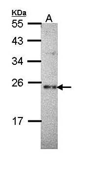 calcium binding protein P22 antibody