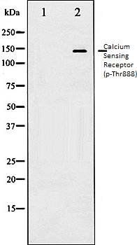 Calcium Sensing Receptor (phospho-Thr888) antibody