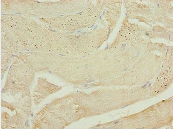 CALCOCO2 Antibody