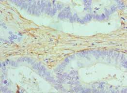 CALD1 Antibody