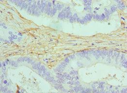 CALD1 antibody