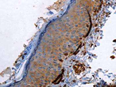 CALD1 Antibody