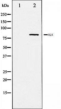 Caldesmon (phospho-Ser789) antibody