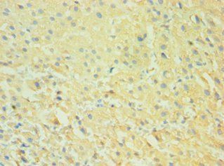 CALHM1 Antibody