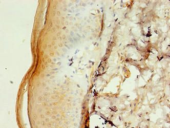 CALML5 Antibody