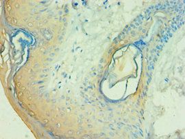 CALML5 Antibody