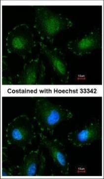 Calpain 5 Rabbit Polyclonal Antibody
