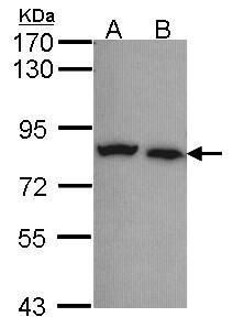 Calpain 5 Rabbit Polyclonal Antibody