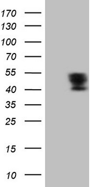 Calpain 5 (CAPN5) antibody