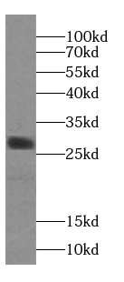 Calpain S2 antibody
