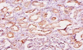 CAST Antibody