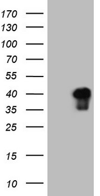 Calprotectin (S100A9) antibody