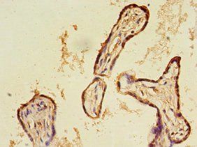 CALR Antibody