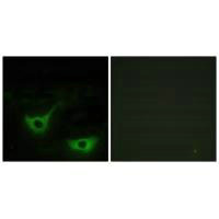 CALR Antibody