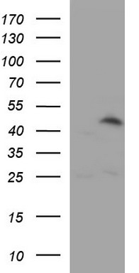 Calreticulin 3 (CALR3) antibody