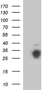 Calreticulin 3 (CALR3) antibody