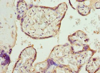 CALR Antibody