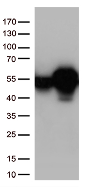 Calreticulin (CALR) antibody