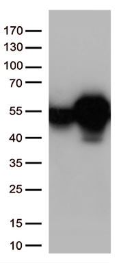 Calreticulin Antibody