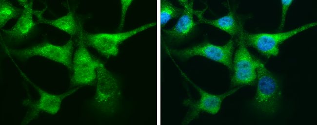 Calretinin antibody