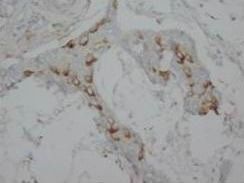 Anti-Calretinin/CALB2 Antibody