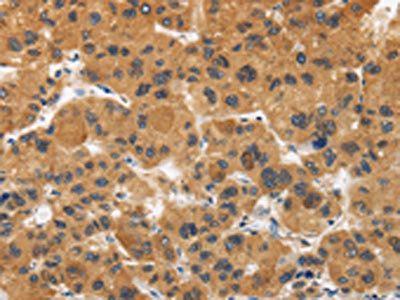 CALU Antibody