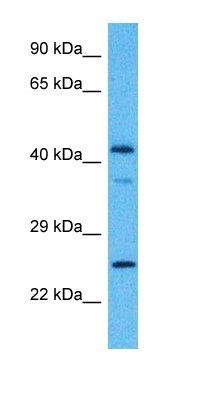 CAMK1D antibody