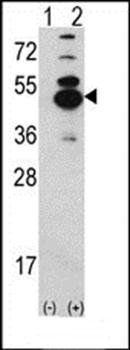 CAMK1D antibody