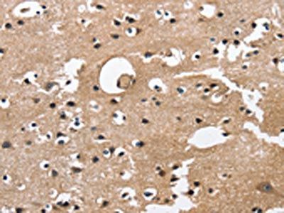 CAMK1D Antibody