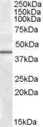 CAMK1D antibody