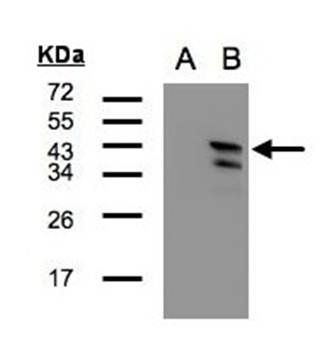 CAMK1D antibody