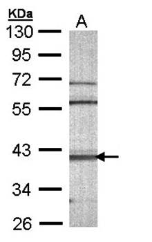 CAMK1D antibody